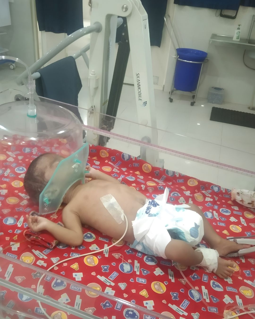 An infant in a hospital bassinet receiving oxygen through a mask, with monitoring lines attached.