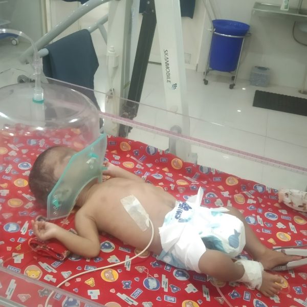 An infant in a hospital bassinet receiving oxygen through a mask, with monitoring lines attached.